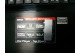 Ноутбук MSI GT70 2PC Dominator б/у (17.3/i7/16/GTX870/1T/Win8) фото №4